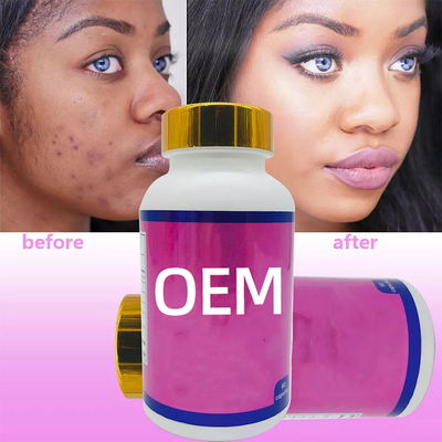 OEM Glutathione thuốc làm trắng da 60pcs/Soft Gel